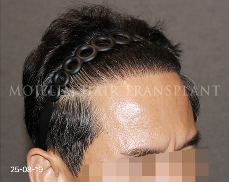After