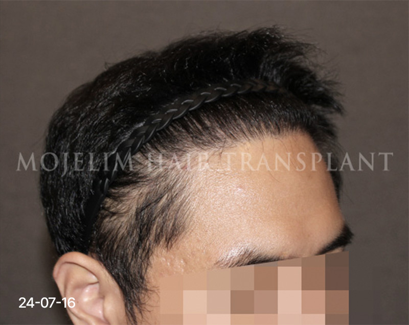 After