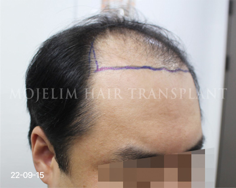 Before