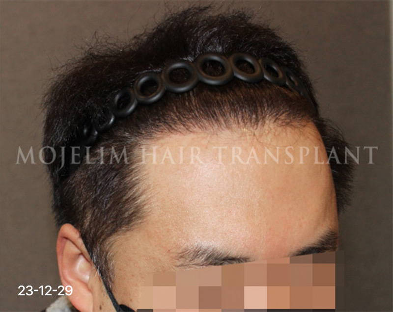 After