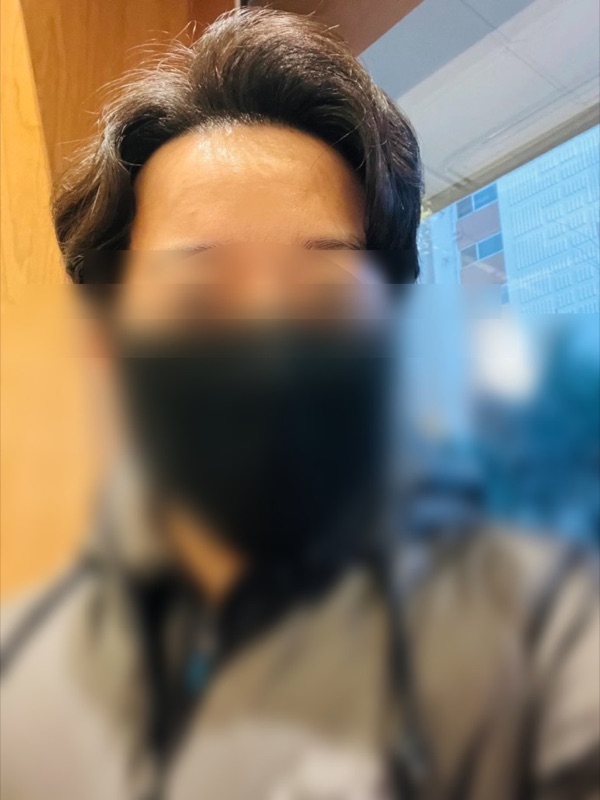 2년 되기 2일전 모발이식 후기